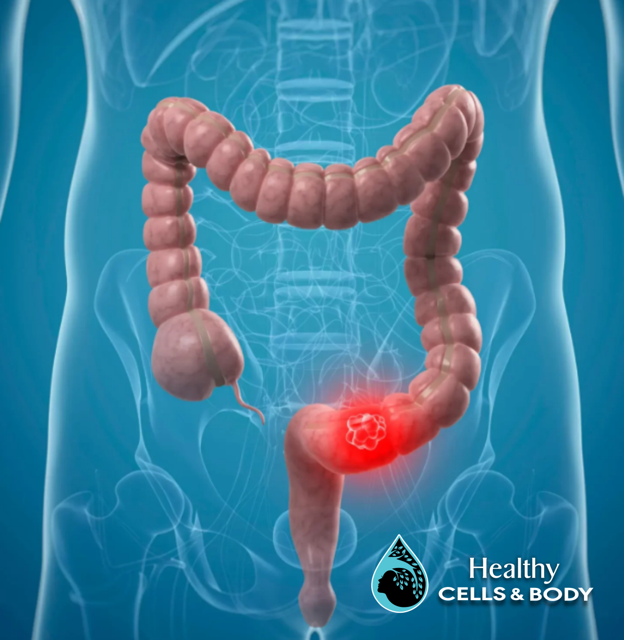 Colon hydrotherapy